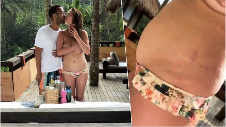Chrissy Teigen Gets Real About Her &lsquo;Mom Bod&rsquo;, Posts Honest Video About Her Insecurities on Twitter