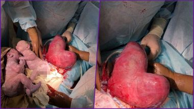 Russian Mom With a Heart-Shaped Womb Gave Birth to Twins! View Pic