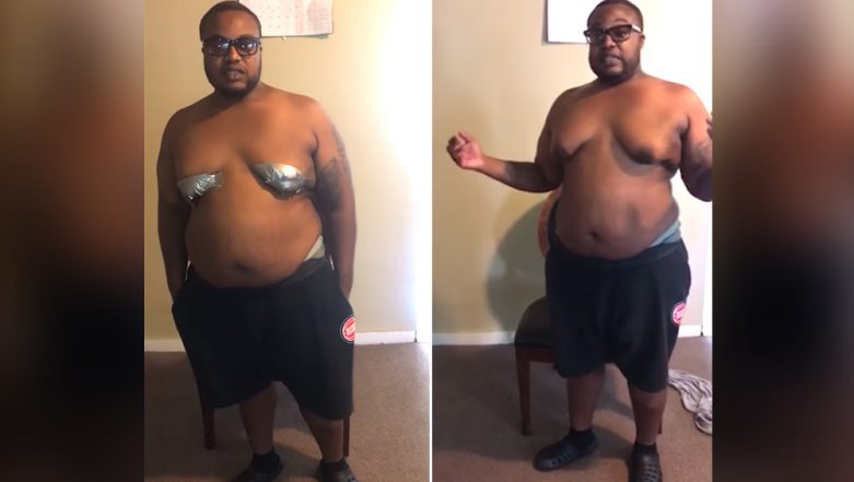 The man whose C-cup moobs are so big he has to tape them down