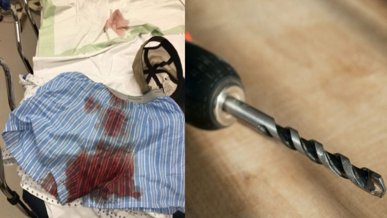 UFC Fighter Accidentally Tears His Scrotum With a Power Drill