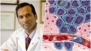 Indo-American Professor Arul Chinnaiyan Awarded USD 6.5 Million To Identify Cancer Biomarkers