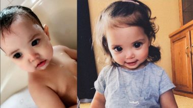 Little Girl With Big Beautiful Eyes Suffers From Axenfeld-Gieger Syndrome (View Her Gorgeous Pics)