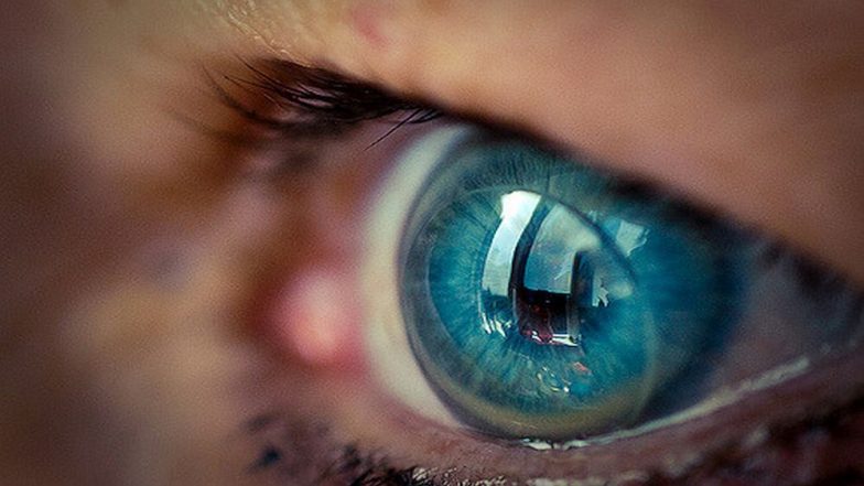 Contact Lens Can Cause Blindness! 8 Hygiene Tips To Keep Your Contacts Clean