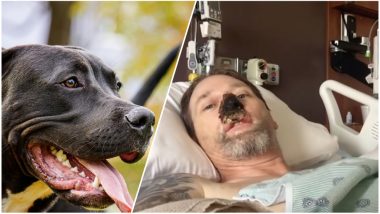 ‘I’ll Always Love Dogs,’ Says Man Who Lost His Limbs After Getting Licked By Pet