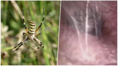 Doctors Find Live Spider Spinning Webs Inside Chinese Man's Ear, Watch Video!