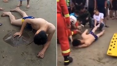 Stingray Stings Man on Penis in China's Resort, Watch Video