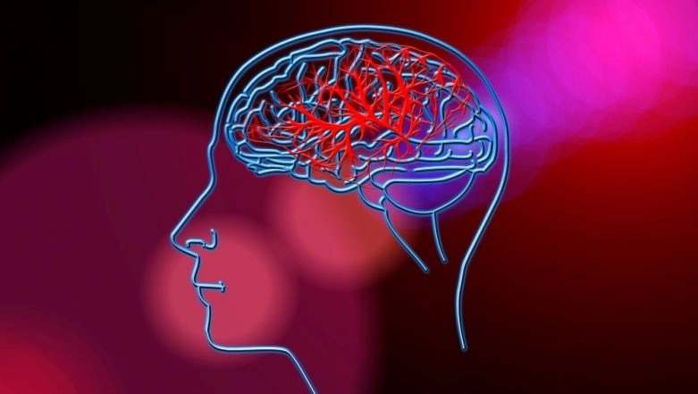 50 People Suffer Stroke or Brain Attack Daily