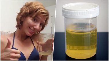 US Woman 'Cures' Acne By Applying Pee On Face! Here's What You Should Know About Urine Therapy