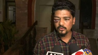 Mumbai: Times Now Journalist Attacked With Knuckle Duster