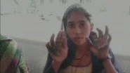 Mathura Shocker: In-Laws Accused of Burning Girl's Hands on Suspicion of Adultery