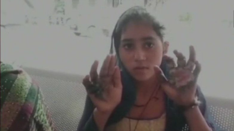 Mathura Shocker: In-Laws Accused of Burning Girl's Hands on Suspicion of Adultery