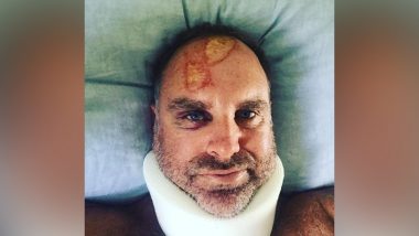 Matthew Hayden Shares Injury Pic, Jonty Rhodes Wonders 'If It's Map of Tamil Nadu' on Australian Batsman Head