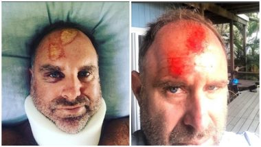 Matthew Hayden ‘Dodges a Bullet’: Australian Cricket Great Fractures Spine in Surf Accident in Queensland; View Pics