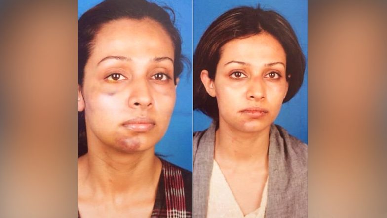 Flora Saini Accuses Aankhen Producer Gaurang Doshi of Physical Abuse - See SHOCKING Pic