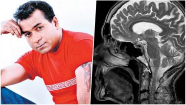 Why Minor Topical Injuries After Accidents Shouldn’t Be Ignored; What We Can Learn From Singer Nitin Bali’s Death