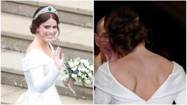 Princess Eugenie Shows Off Her Scoliosis Surgery Scar in Royal Wedding Dress! Know All About the Medical Condition of the Spine