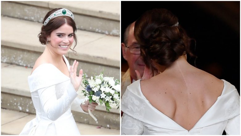 Princess Eugenie Shows Off Her Scoliosis Surgery Scar in 