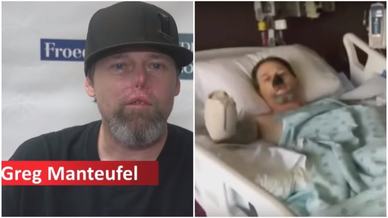 Wisconsin Man Who Lost His Limbs to Due to Bacteria From Dog Lick Hopeful of Walking Again