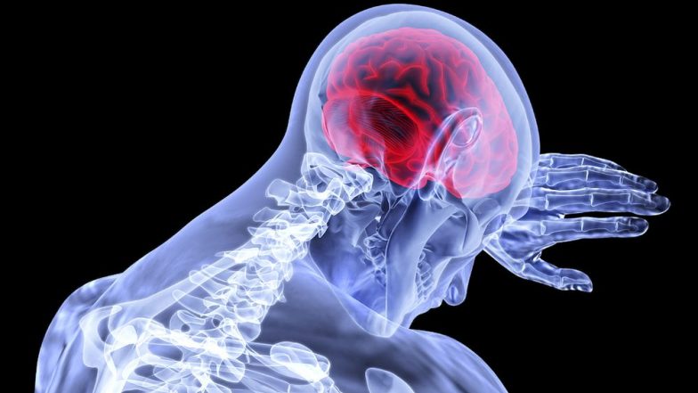 World Stroke Day 2018: What is a 'Silent' Stroke? Know Its Causes, Symptoms, Treatment and Preventive Measures
