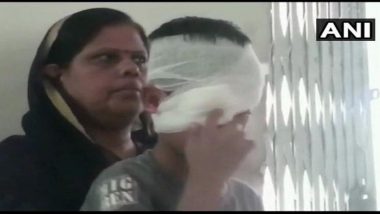 Madhya Pradesh Teacher Thrashes Class 2 Student; Gets Him Severely Injured in Eyes