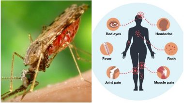 Zika Virus Disease: What Are The Causes, Symptoms and Treatment of This Mosquito-Borne Illness