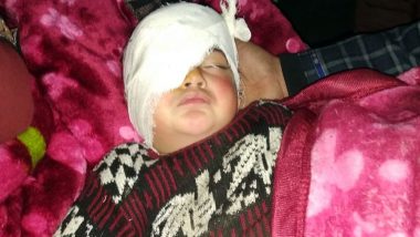 Jammu and Kashmir: 19-Month-Old Hiba Becomes Youngest Pellet Victim, May Lose Eye-Sight