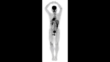 World's First Total-body Scanner Produces 3D Human Images