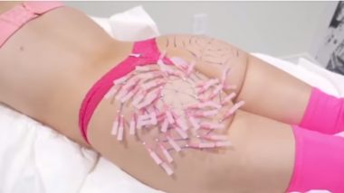 Mother Takes 100 Injections on Her Butt For 'Spider Web Butt Lift' To Prevent Sagging, Watch Video