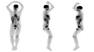 World&rsquo;s First Total-Body Scanner Reveals Pictures of Full Human Body Scan