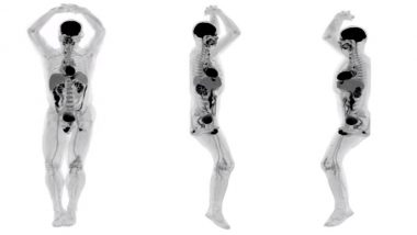 World’s First Total-Body Scanner Reveals Pictures of Full Human Body Scan