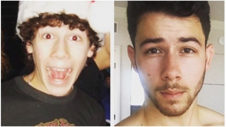 Nick Jonas Opens Up About Being Diagnosed With Type 1 Diabetes! After 13-Years Priyanka Chopra’s Fiance Is in Full Control – View Pic