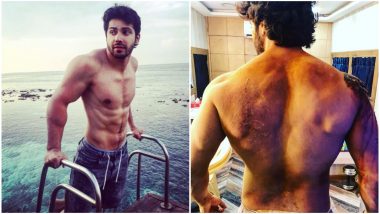 Varun Dhawan Shows Off His 'Battle Scars' From Gruelling Kalank Shoot and We Want Him To Slow Down! View Pic