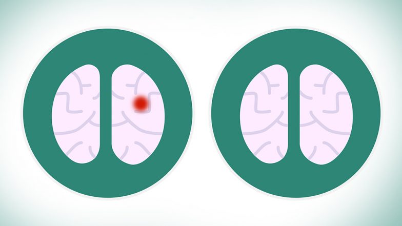 Girl’s Brain Tumour Disappears Miraculously, Doctors Baffled How At The Sudden Vanishing of The Disease