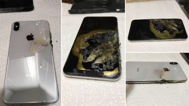 Newly Bought Apple iPhone XS Max Explodes in Pocket Claims Ohio Owner; Files Lawsuit Against Apple: View Pics