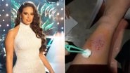 Miss Universe Beauty Pageant 2018: Ashley Graham Tumbles Backstage, Shows Nasty Bruises on Her Leg (View Pics)