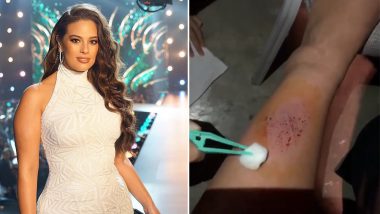 Miss Universe Beauty Pageant 2018: Ashley Graham Tumbles Backstage, Shows Nasty Bruises on Her Leg (View Pics)