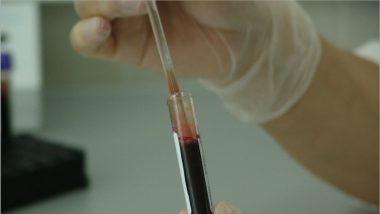 https://st1.latestly.com/wp-content/uploads/2018/12/Australian-scientists-develop-10-minute-cancer-test-380x214.jpg
