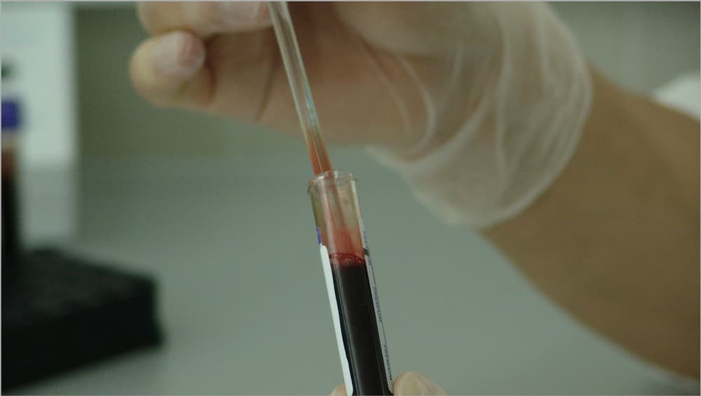 Scientists Join Hands Targeting To Synthesize Compounds To Inhibit Maturation &amp; Propagation
