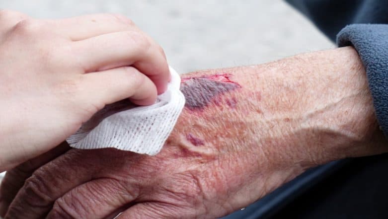 Heal Wound Easily: Wearable Biosensors Can Help Healing Process by Imitating Skin Heal Wound Easily: Wearable Biosensors Can Help Healing Process by Imitating Skin