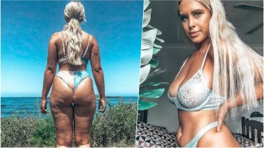 Sydney Woman Shares Picture of Her Cellulite in a Bikini to Promote Body Positivity & Embracing Flaws