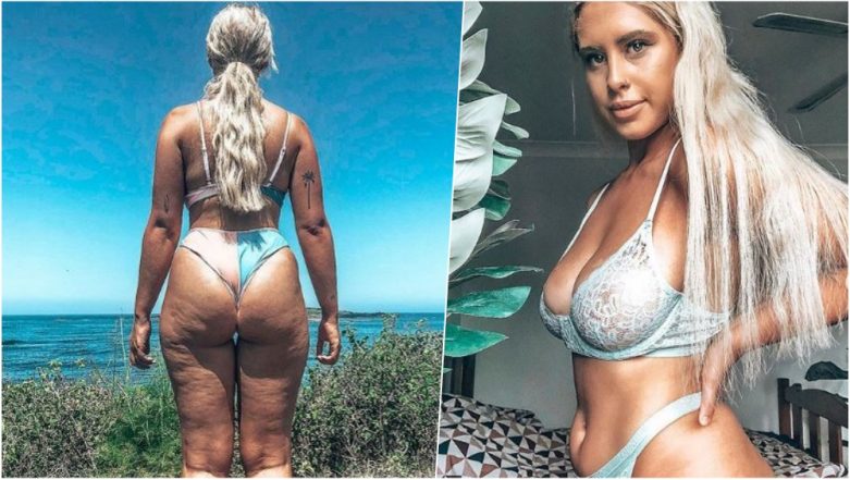 Sydney Woman Shares Picture of Her Cellulite in a Bikini to Promote Body  Positivity & Embracing Flaws