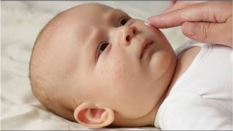 Winter Skin Care Tips for Babies: 6 Ways to Manage Dry and Itchy Skin in Infants