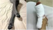 Woman&rsquo;s &lsquo;Snake Stockings&rsquo; Mistaken for Real Snakes, Husband Beats Her with a Baseball Bat (See Pic)
