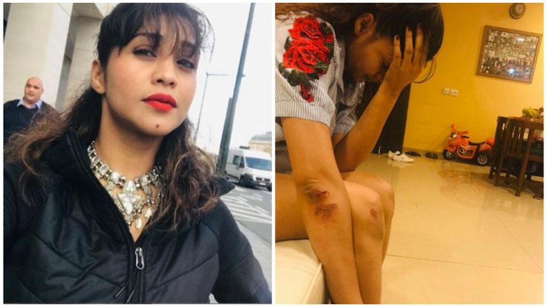 Amrapali Gupta Gets Assaulted For Playing The Vamp In Qubool Hai!