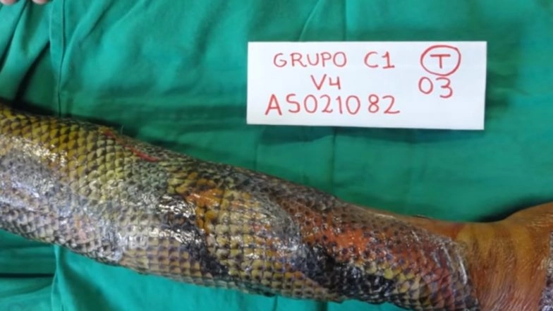 Tilapia Fish Skin Therapy to The Rescue! Here&rsquo;s How Wrapping the Fish Skin Can Be an Effective and Less Painful Way to Treat Burns