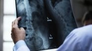 High Dose of X-ray Radiations Increases Cancer Risk for Obese Patients