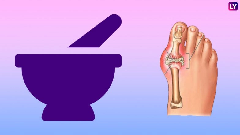 Home Remedy of the Week: 6 Natural Remedies to Reduce Gout Inflammation