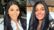 &lsquo;Before and After&rsquo; Cosmetic Surgery Pictures of Sthefany Gutierrez, Miss Universe Venezuela Is Breaking the Internet
