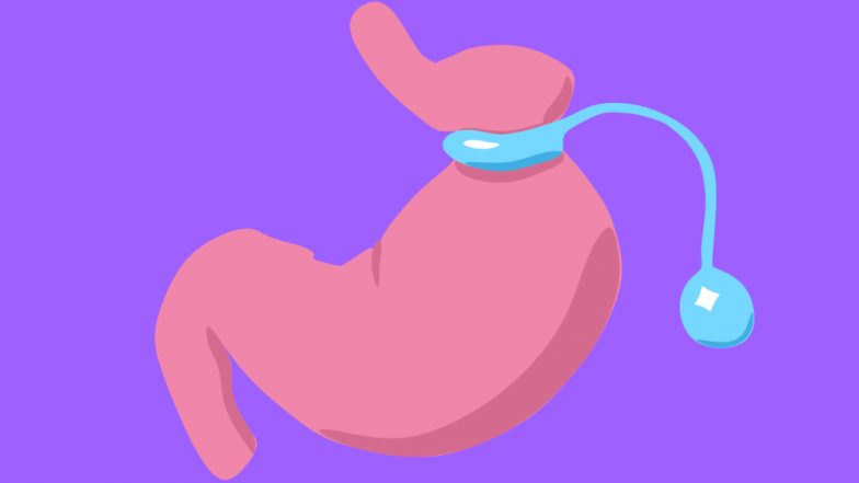Weight Loss Surgery Helps 8-Year-Old Lose 7.6 Kg in 20 Days, Why Bariatric Surgery Is Risky in Children