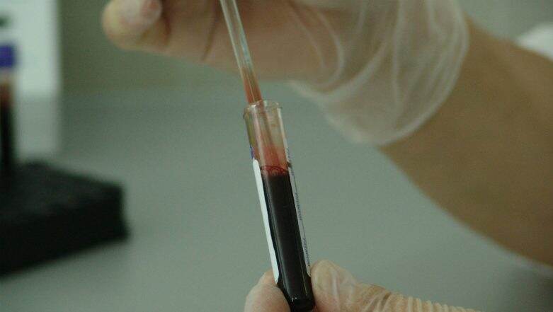 Now, Combination Blood Test for Pancreatic Cancer May Detect Disease Earlier Now, Combination Blood Test for Pancreatic Cancer May Detect Disease Earlier